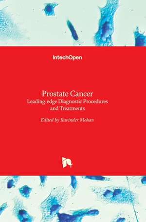 Prostate Cancer de Ravinder Mohan