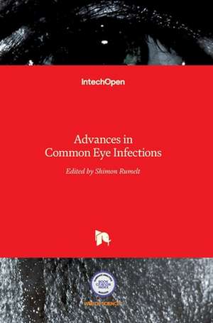 Advances in Common Eye Infections de Shimon Rumelt