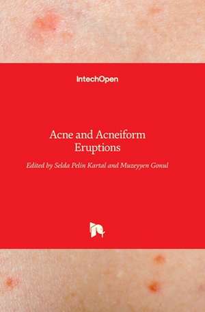 Acne and Acneiform Eruptions de Selda Pelin Kartal