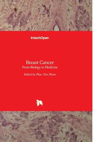 Breast Cancer de Phuc Van Pham