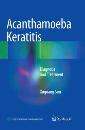 Acanthamoeba Keratitis: Diagnosis and Treatment de Xuguang Sun