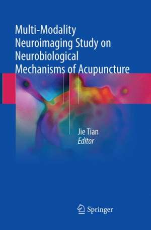 Multi-Modality Neuroimaging Study on Neurobiological Mechanisms of Acupuncture de Jie Tian