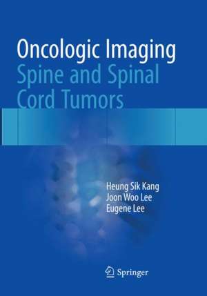 Oncologic Imaging: Spine and Spinal Cord Tumors de Heung Sik Kang