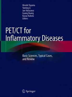 PET/CT for Inflammatory Diseases: Basic Sciences, Typical Cases, and Review de Hiroshi Toyama