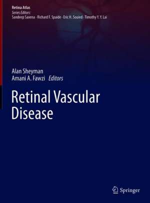 Retinal Vascular Disease de Alan Sheyman