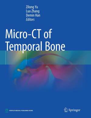 Micro-CT of Temporal Bone de Zilong Yu