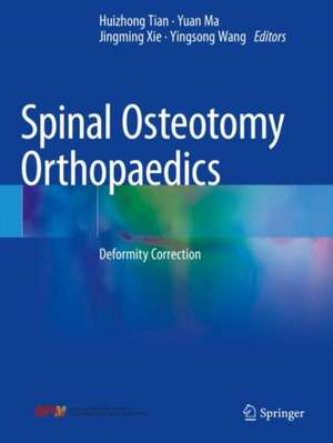 Spinal Osteotomy Orthopaedics: Deformity Correction de Huizhong Tian