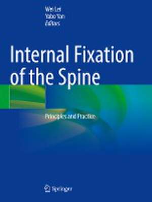 Internal Fixation of the Spine: Principles and Practice de Wei Lei