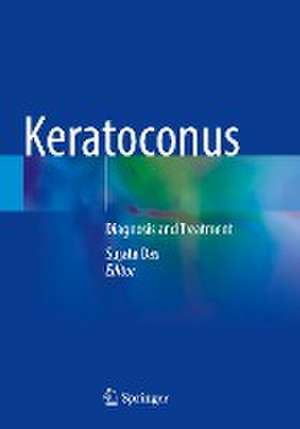 Keratoconus: Diagnosis and Treatment de Sujata Das