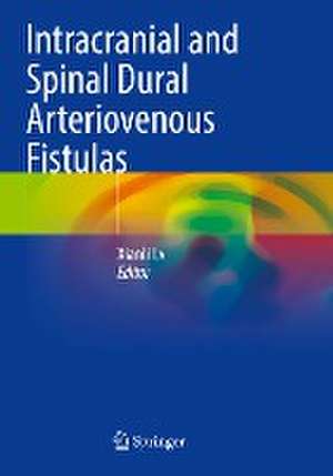 Intracranial and Spinal Dural Arteriovenous Fistulas de Xianli Lv