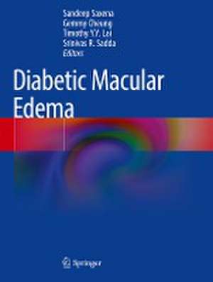 Diabetic Macular Edema de Sandeep Saxena