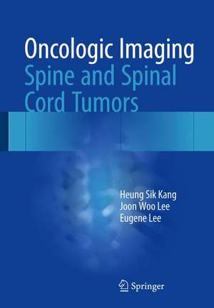 Oncologic Imaging: Spine and Spinal Cord Tumors de Heung Sik Kang