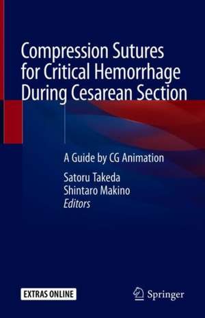 Compression Sutures for Critical Hemorrhage During Cesarean Section: A Guide by CG Animation de Satoru Takeda