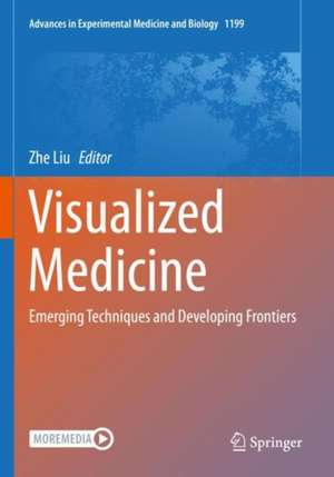 Visualized Medicine de Zhe Liu