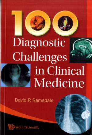 100 Diagnostic Challenges in Clinical Medicine: Proceedings of the Fourth Argonne/INT/MSU/JINA FRIB Theroy Workshop de DAVID R RAMSDALE