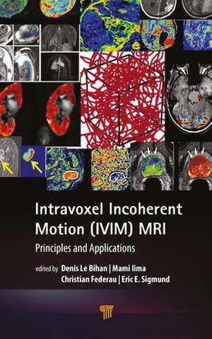 Intravoxel Incoherent Motion (IVIM) MRI: Principles and Applications de Denis Le Bihan