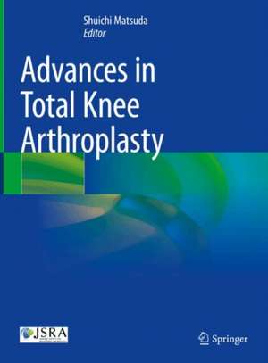 Advances in Total Knee Arthroplasty de Shuichi Matsuda