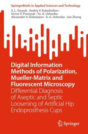 Digital Information Methods of Polarization, Mueller-Matrix and Fluorescent Microscopy: Differential Diagnosis of Aseptic and Septic Loosening of Artificial Hip Endoprosthesis Cups de V. L. Vasyuk