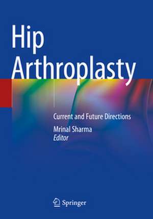 Hip Arthroplasty de Mrinal Sharma
