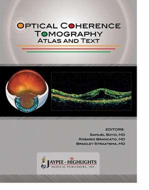 Optical Coherence Tomography: Atlas and Text de Samuel Boyd