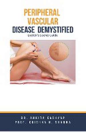 Peripheral Vascular Disease Demystified de Ankita Kashyap