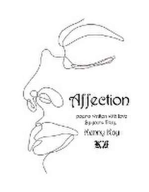 Affection de Kenny Kay