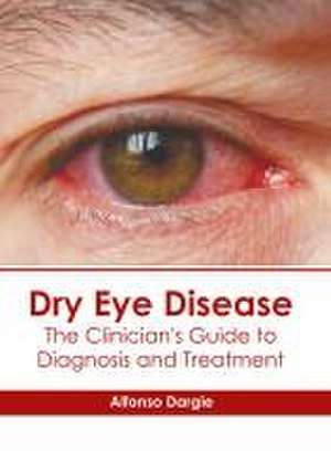 Dry Eye Disease: The Clinician's Guide to Diagnosis and Treatment de Alfonso Dargie