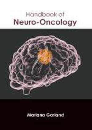 Handbook of Neuro-Oncology de Mariana Garland