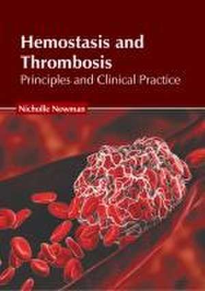 Hemostasis and Thrombosis: Principles and Clinical Practice de Nicholle Newman