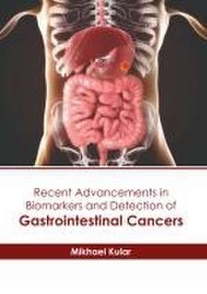 Recent Advancements in Biomarkers and Detection of Gastrointestinal Cancers de Mikhael Kular