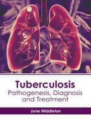 Tuberculosis: Pathogenesis, Diagnosis and Treatment de June Middleton