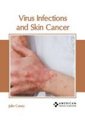 Virus Infections and Skin Cancer de Julio Casey