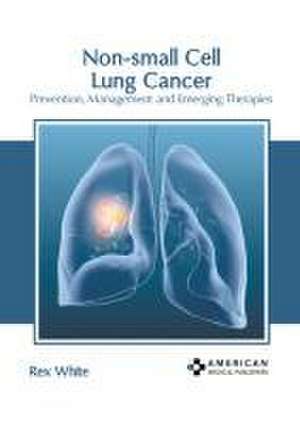 Non-Small Cell Lung Cancer: Prevention, Management and Emerging Therapies de Rex White