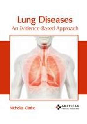 Lung Diseases: An Evidence-Based Approach de Nicholas Clarke