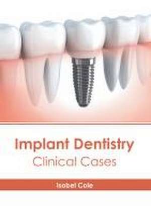 Implant Dentistry: Clinical Cases de Isobel Cole