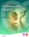 The ESC Textbook of Cardiovascular Imaging