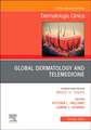 Global Dermatology and Telemedicine, An Issue of Dermatologic Clinics