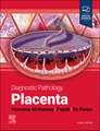 Diagnostic Pathology: Placenta