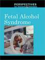 Fetal Alcohol Syndrome