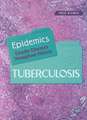 Tuberculosis