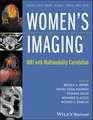 Women′s Imaging – MRI with Multimodality Correlation