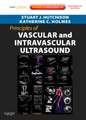 Principles of Vascular and Intravascular Ultrasound: Expert Consult - Online and Print