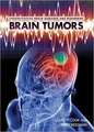 Brain Tumors