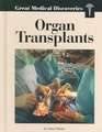 Organ Transplants