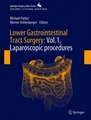 Lower Gastrointestinal Tract Surgery: Vol.1, Laparoscopic procedures