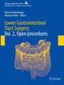 Lower Gastrointestinal Tract Surgery: Vol. 2, Open procedures