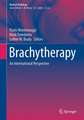 Brachytherapy: An International Perspective