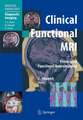 Clinical Functional MRI: Presurgical Functional Neuroimaging