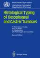 Histological Typing of Oesophageal and Gastric Tumours: In Collaboration with Pathologists in 8 Countries