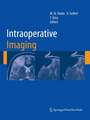 Intraoperative Imaging